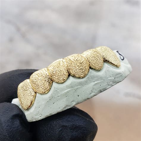 gold diamond dust grillz